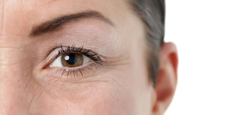 Blepharoplasty in Turkey (What to Expect)