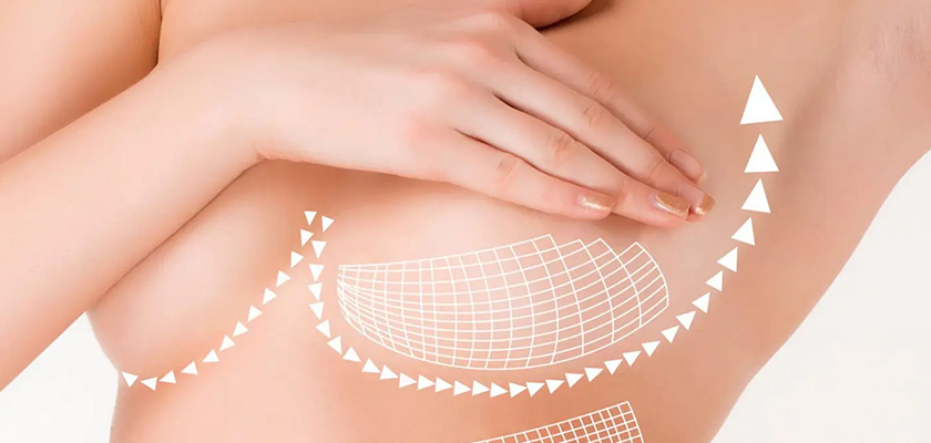 Why is Breast Reconstruction Surgery in Turkey the Best?