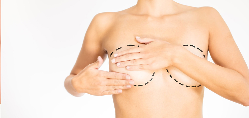 Why Is Breast Reconstruction Surgery in Turkey A Good Idea?