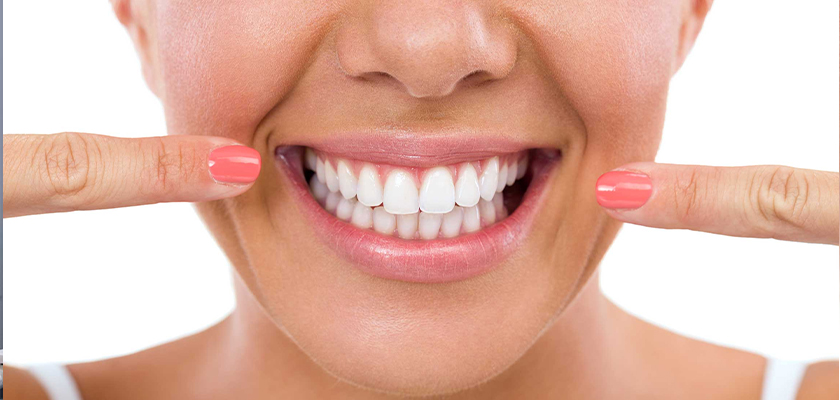 What Does the Process of Teeth Whitening Look Like?