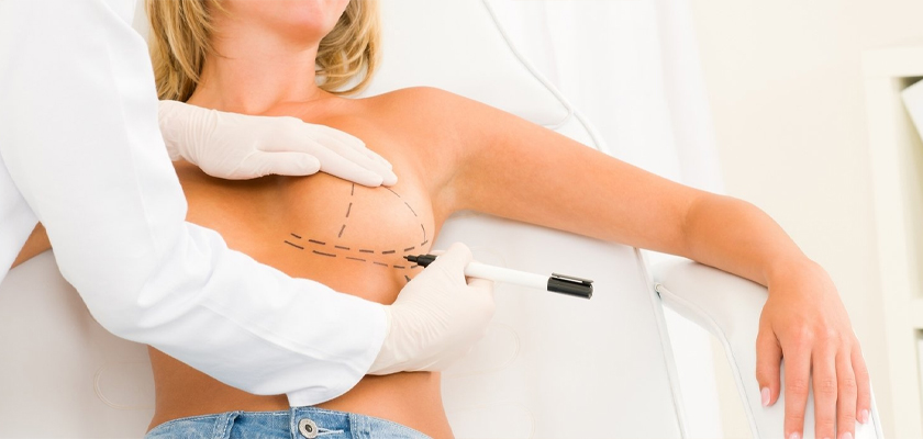 Who is the Best Candidate for Breast Reconstruction Surgery?
