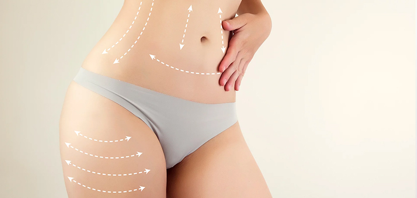 Who is Eligible to Get Liposculpture?